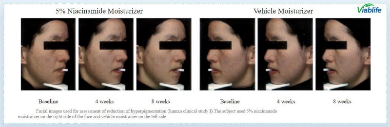 肌を明るくするニコチンアミド Nicotinamide for Skin Brightening